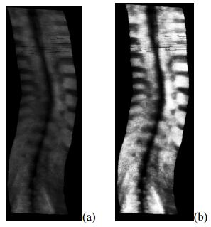 A fast 3-D ultrasound projection imaging method for scoliosis assessment